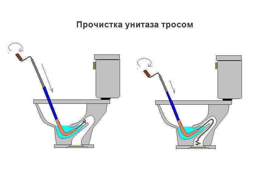 Как прочистить засор унитаза пластиковой бутылкой, содой и уксусом, тросом самостоятельно, фото и видео